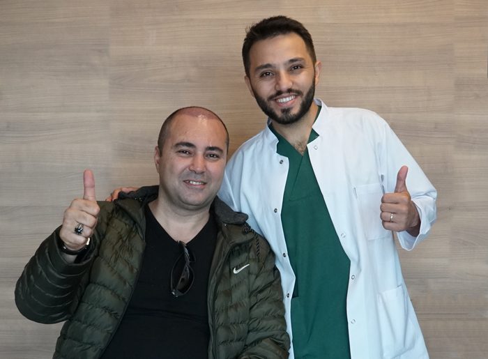 after-hair-transplant-dhiclinicturkey after-hair-transplant-dhiclinicturkey